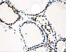 LOX / Lysyl Oxidase Antibody (clone OTI9G6)