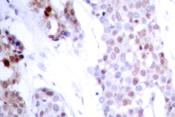 ATF4 Antibody (phospho-Ser245)