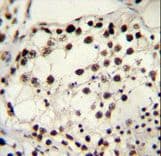 TRIM28 / KAP1 Antibody (aa178-207)