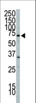 PIK3R2 / p85 Beta Antibody (aa268-298)
