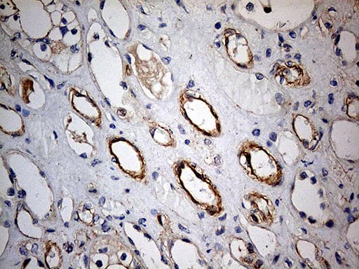 Monoclonal Mouse anti-Human KIF6 Antibody (clone OTI5G2, aa1-350, IHC, WB)