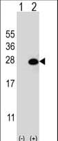 Polyclonal Rabbit anti-Human DGCR6L Antibody (aa108-135, WB)