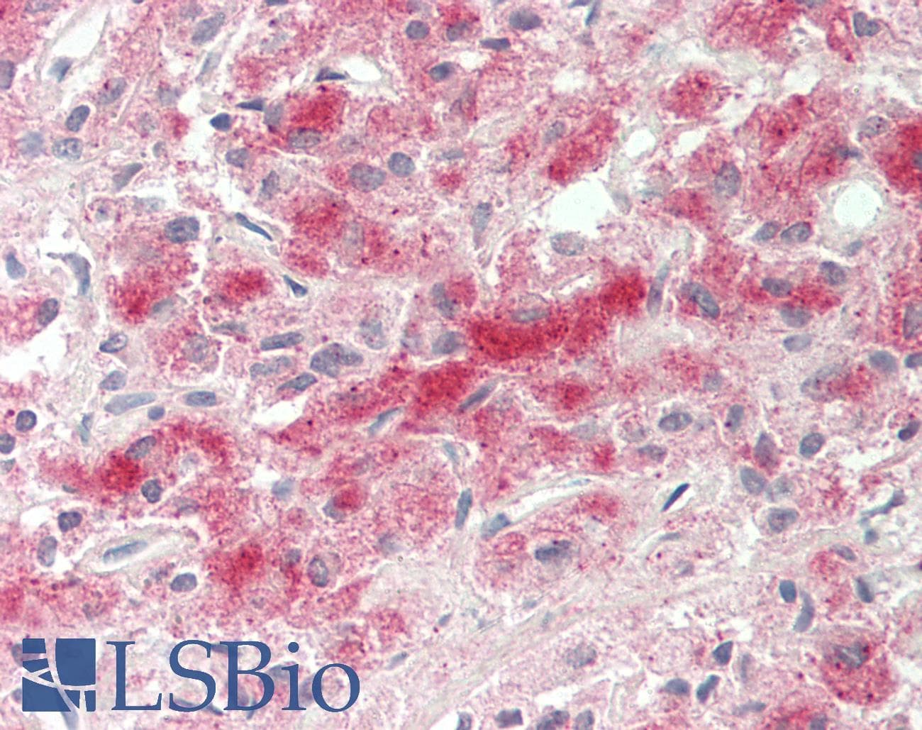 Polyclonal Rabbit anti-Human FBX09 / FBXO9 Antibody (aa179-228, IHC, WB)