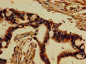 ROR2 Antibody