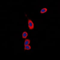 Polyclonal Rabbit anti-Human RPS6KC1 Antibody (Internal, IF, WB)