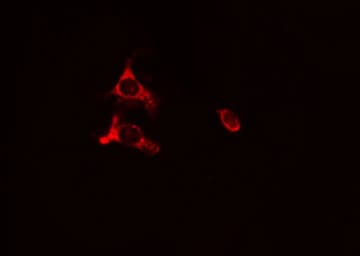 Polyclonal Rabbit anti-Human PC / Pyruvate Carboxylase Antibody (IHC, IF, WB)
