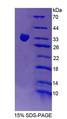 Human SIRPG Protein (Recombinant His-T7)