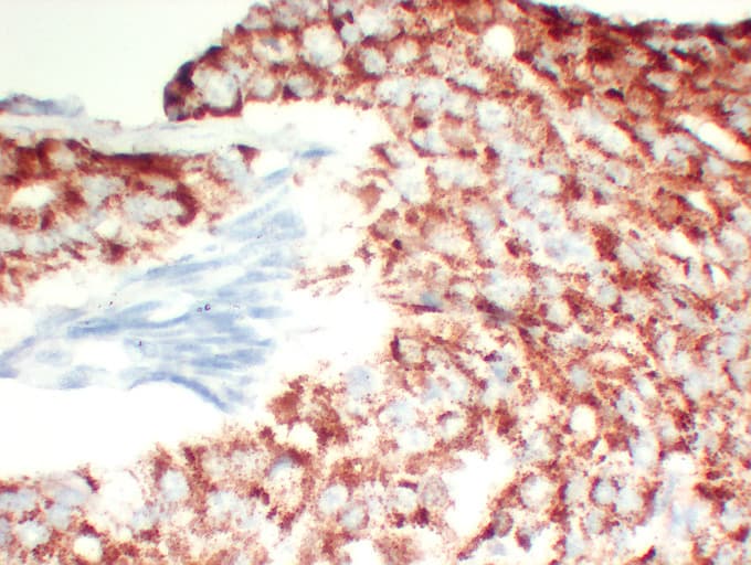 Monoclonal Mouse anti-Human AMACR / P504S Antibody (clone ABT-AMACR, IHC, WB)