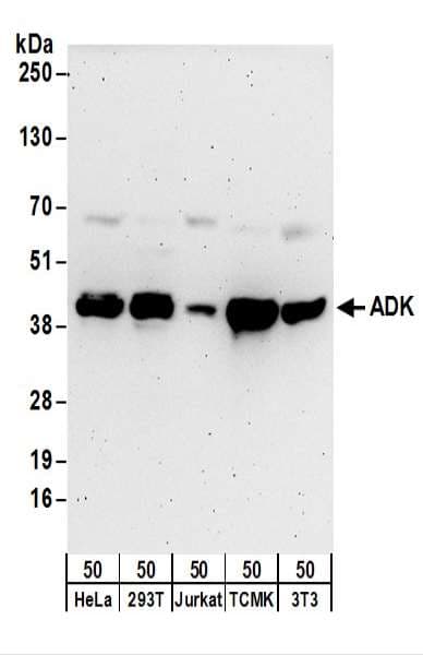 IHC-plus™ ADK / Adenosine Kinase Antibody (aa312-362)