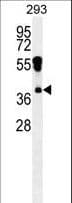 RHOXF2 Antibody (aa1-30)