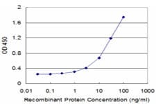 CRYBA2 Antibody (clone 2G9)