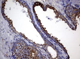 Monoclonal Mouse anti-Human TS / Thymidylate Synthase Antibody (clone 10F12, Carrier-free, IHC, WB)