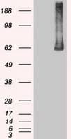 PLK1 / PLK-1 Antibody (clone OTI5C1)