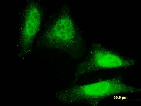 IHC-plus™ DAZ1 / DAZ Antibody (clone 3G10)