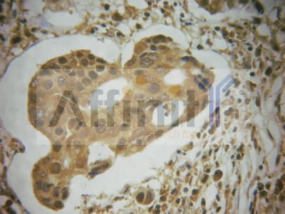 MDM2 Antibody (phospho-Ser166)