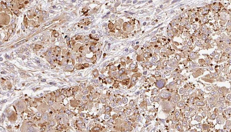 GRM6 / MGLUR6 Antibody