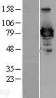 Human EZR / Ezrin Protein (Over-Expression Lysate Myc-DDK (Flag))