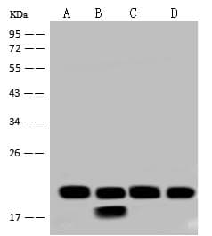 NDUFB7 / B18 Antibody