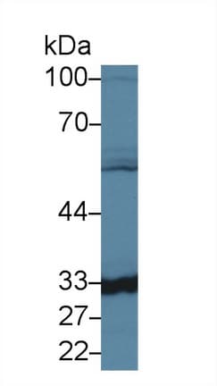 CA-VB / CA5B Antibody (aa63-225)