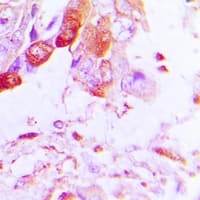 Polyclonal Rabbit anti-Human AQP5 / Aquaporin 5 Antibody (C-Terminus, IHC, WB)