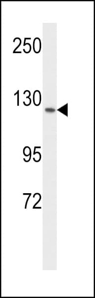 FLT1 / VEGFR1 Antibody