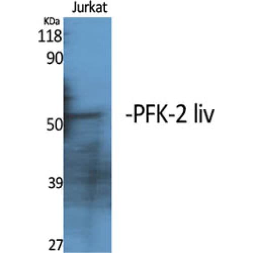 PFKFB1 Antibody (380-460 aa, C-terminal)