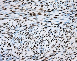 ARNT / HIF-1-Beta Antibody (clone OTI1A1)