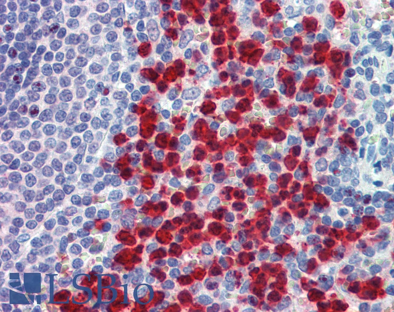 IHC-plus™ Polyclonal Goat anti-Human IGSF4C / CADM4 Antibody (aa370-384, IHC, WB)