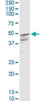 CSF2 / GM-CSF Antibody (clone 2G9)
