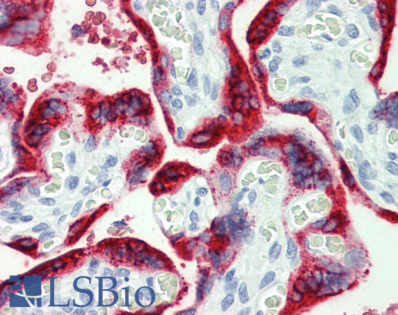 IHC-plus™ GH / Growth Hormone Antibody
