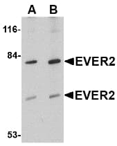 IHC-plus™ TMC8 / EVER2 Antibody
