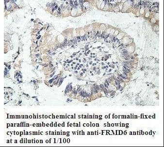 FRMD6 Antibody (aa446-614)