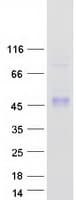 Human SFTPB / Surfactant Protein B (Recombinant Myc-DDK (Flag))