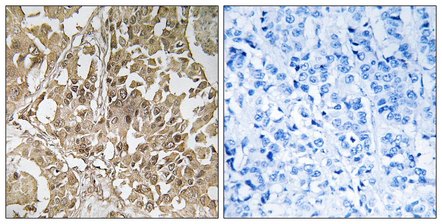 BUB1 Antibody