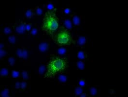 PKMYT1 Antibody (clone OTI5E1)