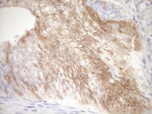 p16INK4a / CDKN2A Antibody (clone OTI5G9)