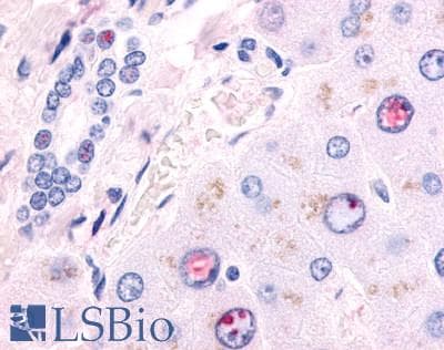 IHC-plus™ Polyclonal Rabbit anti-Human EAR2 / NR2F6 Antibody (Ligand-binding Domain, IHC)