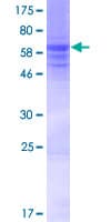 Human KLHDC8A Protein (Recombinant GST)