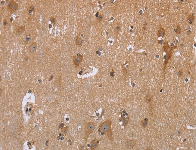 GABPB2 Antibody