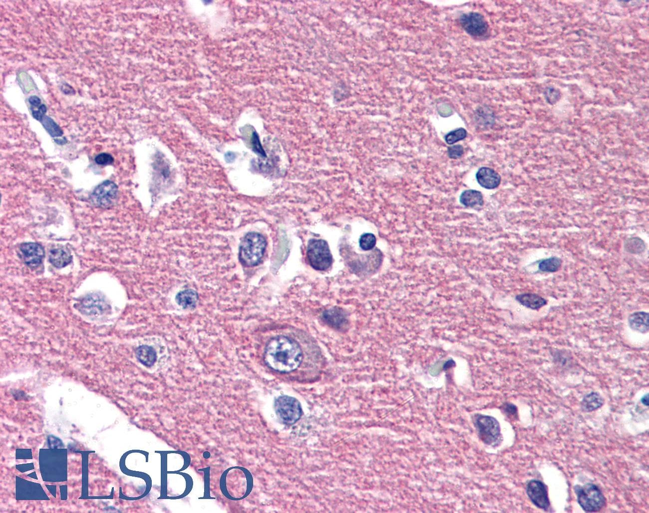 IHC-plus™ CADM2 Antibody (Internal)