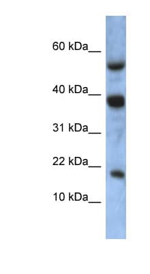 ATXN7L1 Antibody (aa35-84)