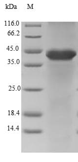 Human FAM96B Protein (Recombinant GST, N-terminus)