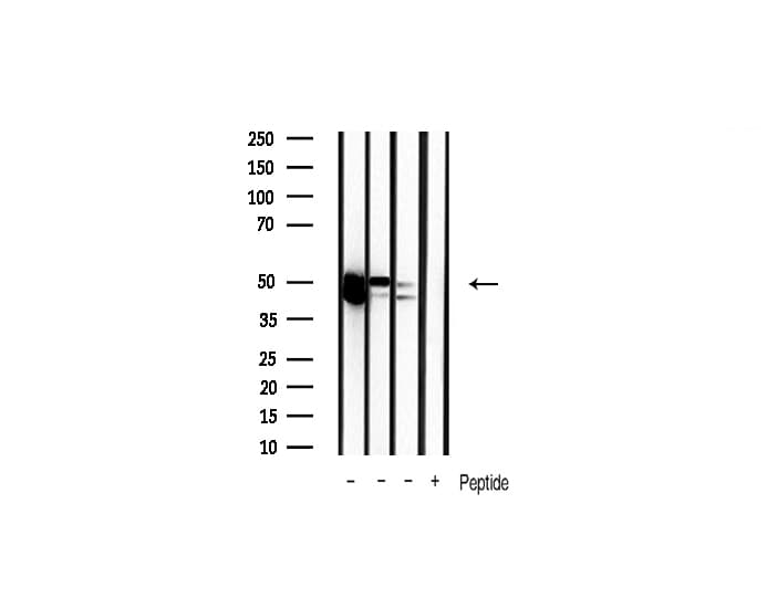 Polyclonal Rabbit anti-Human MAPK3 / ERK1 Antibody (IHC, IF, WB)