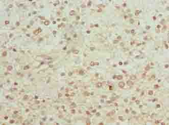 IHC-plus™ PGM2L1 Antibody