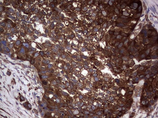 GARS / Glycyl tRNA Synthetase Antibody (clone OTI4G4)