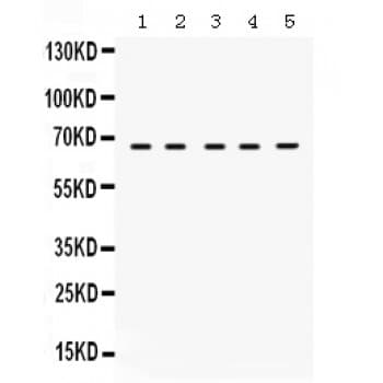 STXBP1 / MUNC18-1 Antibody (aa184-216)