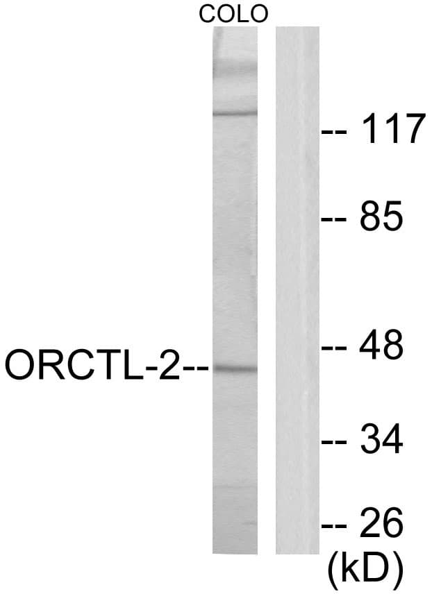 SLC22A18 Antibody (aa359-408)