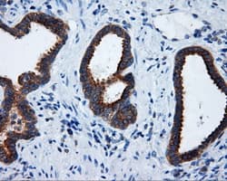 Monoclonal Mouse anti-Human RIP1 / RALBP1 Antibody (clone OTI2A6, IHC, IF, WB)