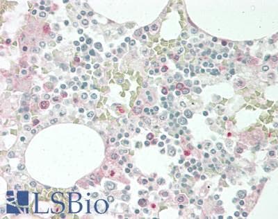 Polyclonal Rabbit anti-Human EREG / Epiregulin Antibody (aa30-169, IHC, WB)