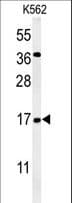 NAA50 / NAT13 / SAN Antibody (aa117-146)